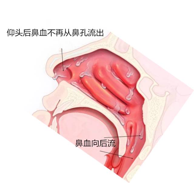 重庆看壁比鼻出血的医院