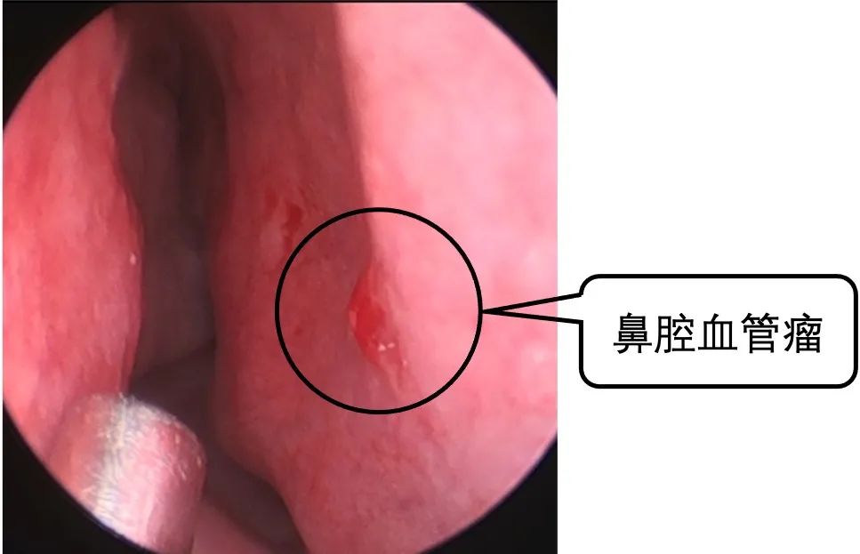 耳鼻喉医院哪家好